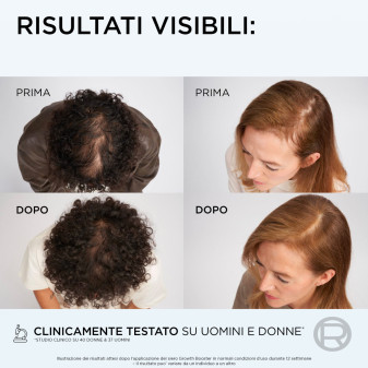 L'Oréal Paris Elvive Growth Booster Siero Anticaduta